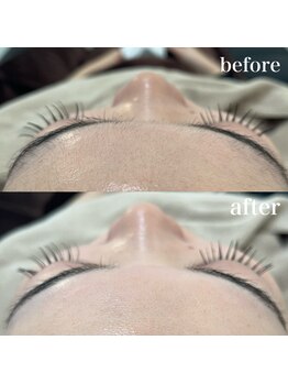 ラクシー 御徒町(luxssy)/顔シェービング