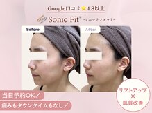 リリーオン 福岡店(RILLEE-ON)の雰囲気（これこそが真のオーダーメイド施術！だから結果に違いが出ます。）
