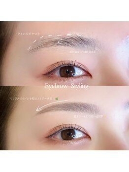 エメリーヌ 中目黒(Aimeline)/Before &After