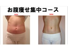 【キャビ＋ラジオ波＋EMS】で気になる部分を集中シェイプ！