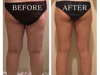 ヨサパーク アーバンヘブン 目黒(YOSA PARK Urban Heaven)