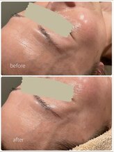 カイト(Kaito)/ビフォーアフター