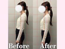 アルピラティス 池尻大橋(AruPilates)/下腹ぽっこりの原因は？