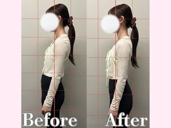 アルピラティス 池尻大橋(AruPilates)/下腹ぽっこりの原因は？