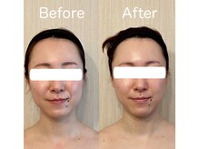 サロン ド シャルール/歪み改善