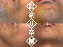 サロン ド マキ(Salon de Maki)の雰囲気（効果を実感する脱毛！コスパ・タイパ◎お肌スベスベ&ツルツルへ）