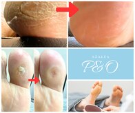ピーアンドオー(P&O)