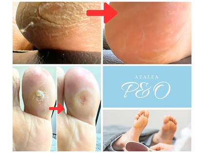 ピーアンドオー(P&O)の写真