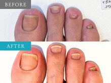 育爪 梅田店/育爪カルテ