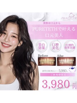 ピュアティス(PURETETH)/ホワイトニング