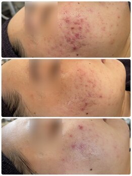 ビーエスアクアビューティー/