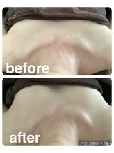 ギンザアール(GINZA R.)/バストケア！