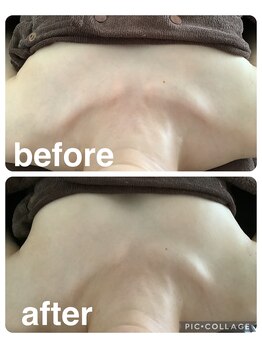 ギンザアール(GINZA R.)/バストケア！