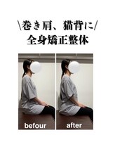 はぴねす鍼灸整骨院 飯田橋サクラテラス院/【飯田橋院】施術変化1回