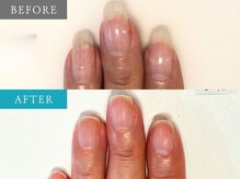 育爪 梅田店/育爪カルテ