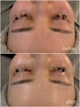 プレシア(Plecia)/クリスティーナ／アンストレス