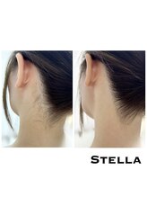 ステラ(Stella)/人気のうなじ脱毛で垢抜けも☆