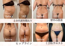 つばめの巣 山科