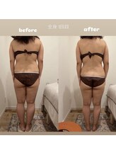 &still【アンドスティル】【4/1 NEW OPEN（予定）】 /【痩身リンパ全身＆よもぎ蒸し】