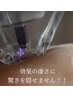 限定価格【¥15000→¥12000】プラズマ微細針＋世界特許取得エクソソーム導入