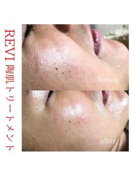 ネコロビヤ(Necorobi家)/お肌のお悩み改善