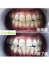 ルブラン 奈良店(Le Blanc)/葉が黄色くなるのは?