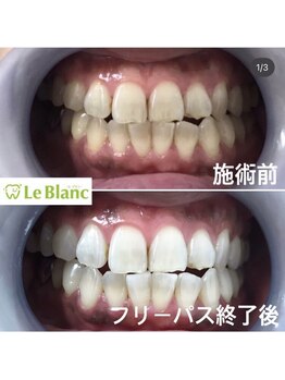 ルブラン 奈良店(Le Blanc)/葉が黄色くなるのは?