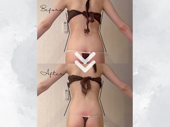 サイバーエステ 宇都宮店/キレイなくびれ、手に入れる？