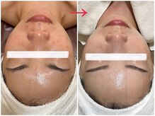 オージャス(OJAS)の雰囲気(ノーファンデ艶玉肌を手に入れ、お肌も心も潤う人生に!)