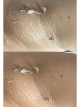 ツボミ(tubomi)/ローマピンク｜その他…１