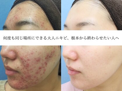 エピア 西尾店(Epia)の写真