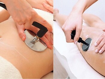 エステティック リオン(Rion)の写真/医療従事者の方へ感謝キャンペーン！【インディバ痩身★90分￥7980】　癒されながら痩せる♪首肩凝りにも◎