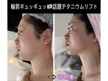アルページュ(Arpege)