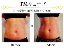 スパイア(SPIRE)/TMキューブ★お腹