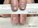 自爪育成 3ヶ月コース