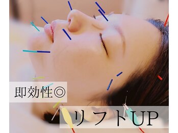 はりと美容鍼灸治療院(HaRi&美容鍼灸治療院)/1回の施術で・・・