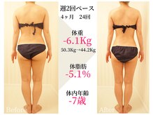 ベルタ 仙台店(BELTA)/【ケア前→後】4ヶ月で-6.1キロ