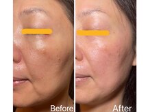 アプローズ(APPLAUSE)/最先端幹細胞