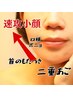 【話題の脂肪分解レモンボトル】二重顎撃退フェイシャル！ダウンタイムなし◎