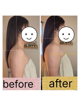 ニュートラル(neutral)/巻き肩改善