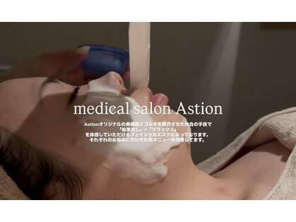アスティオン(Astion)の写真