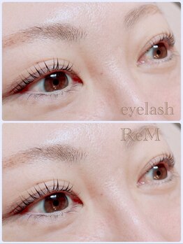 リエム(ReM)/マシュマロロッド!!