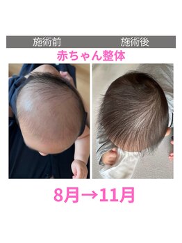 らくだ整骨院/赤ちゃん整体