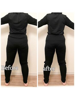 ヨサパーク リコア(YOSA PARK Likoa)/beforeAfter