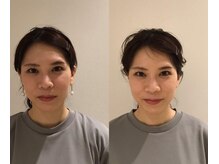 mano【小顔矯正/リンパマッサージ/筋膜リリース】/小顔矯正