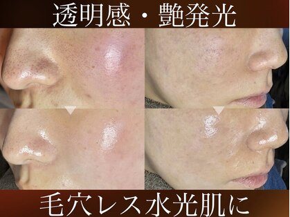 ブラックボックス(BLACK BOX)の写真