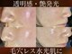 ブラックボックス(BLACK BOX)の写真