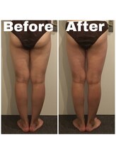 トータルビューティサロン エクスト(EXT)/ラフォス×ハイパーシェイプ70分