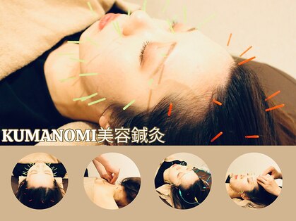 クマノミ美容鍼灸 大宮駅前院(KUMANOMI美容鍼灸)の写真