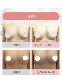 サロン ワン(salon one)/バストアップ